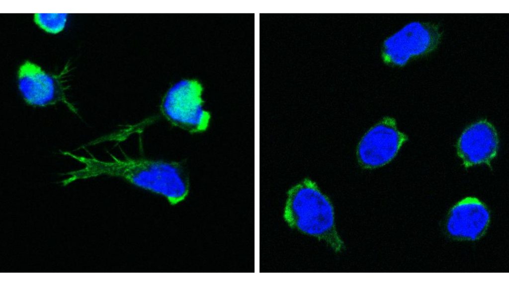 Gesunde T-Zellen (links) und DOCK11-defiziente T-Zellen (rechts) mit sichtbarem Zellkern (blau) und Aktin-Zytoskelett (grün).