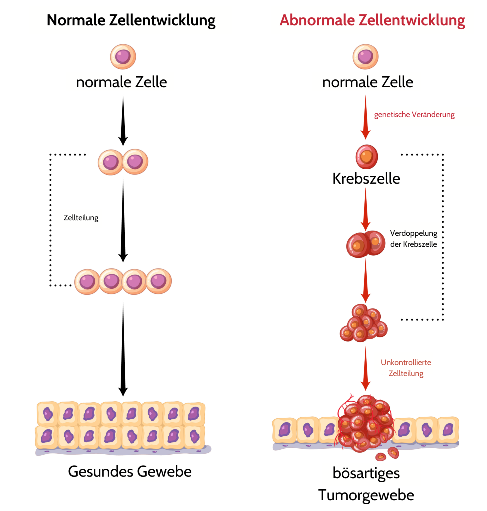 Entwicklung einer Krebszelle