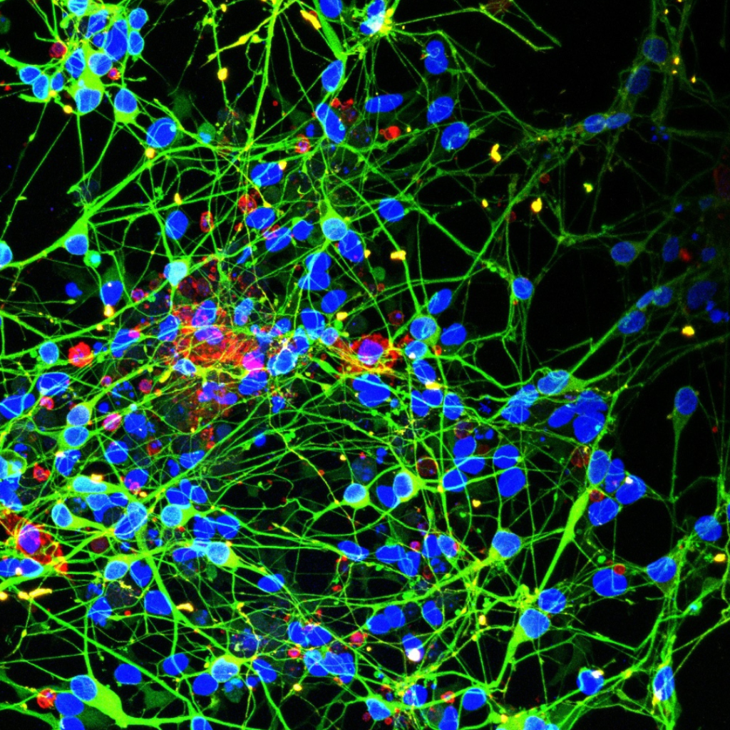 Kinderkrebstag - Krebs bei Kindern